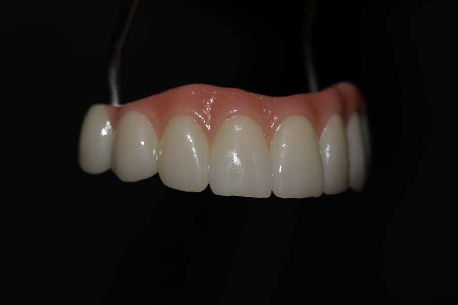 Female smile result