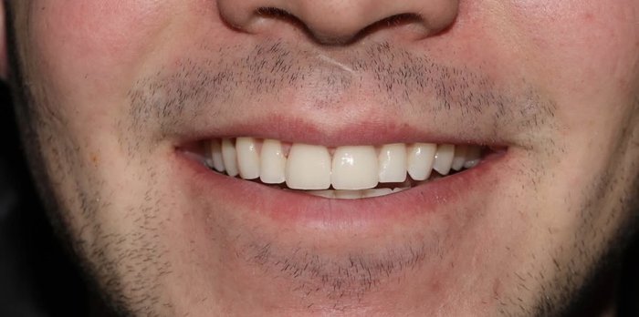 Male smile makeover